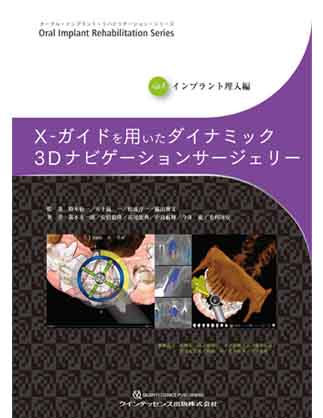 オーラル・インプラント・リハビリテーション・シリーズ　Vol.4 インプラント埋入編